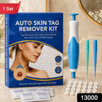 Blue and white skin tag remover kit with applicator, bands, and alcohol pads with a '1 Set' banner.